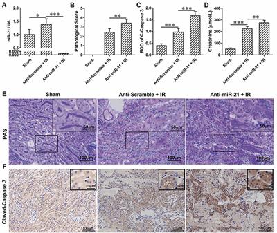 miR-21 Protects Against Ischemia/Reperfusion-Induced Acute Kidney Injury by Preventing Epithelial Cell Apoptosis and Inhibiting Dendritic Cell Maturation